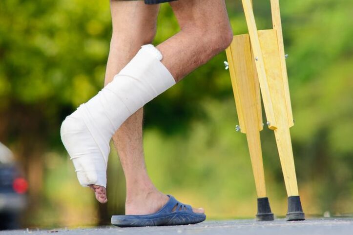 les blessures à la cheville comme cause de l'arthrose