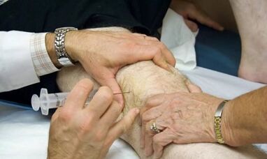 Comment distinguer l'arthrite de l'arthrose